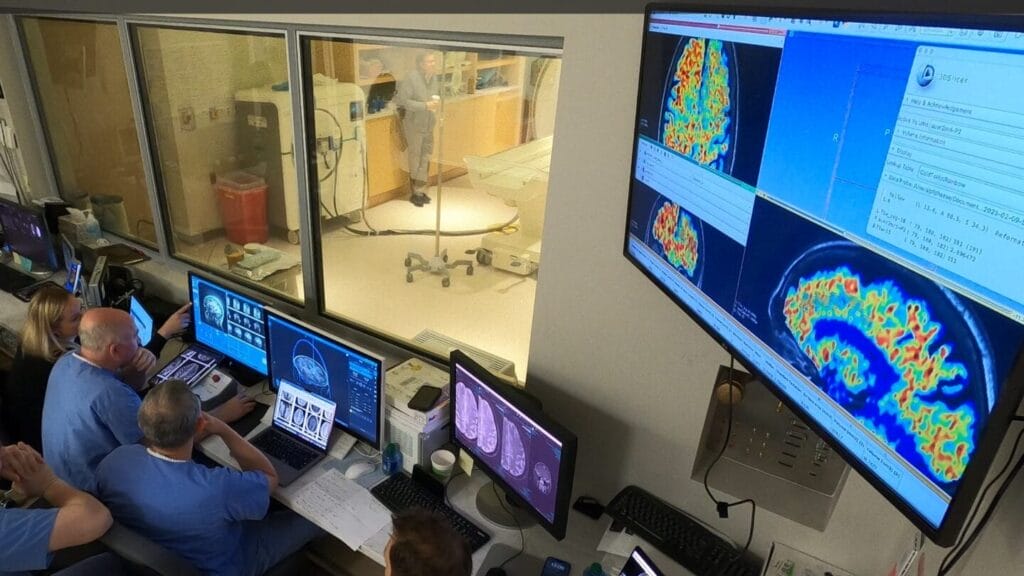 Ultrasound tech could allow for ultrafast Alzheimer’s treatment, study finds